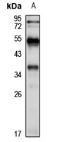 Anti-TMEM74 Antibody