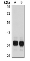 TMX1 antibody