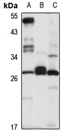 Anti-CD263 Antibody