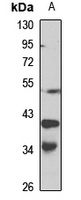 Anti-DCR3 Antibody