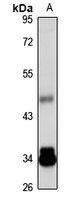 Anti-TNIP2 Antibody