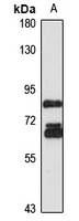 Anti-TNS4 Antibody