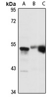 TOM1L1 antibody