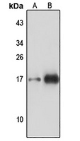 TOM22 antibody