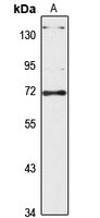 Anti-TOP1MT Antibody