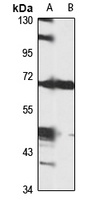 GCX-1 antibody