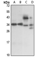 Anti-PRPK Antibody