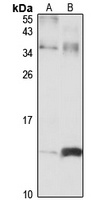 TPD52L3 antibody