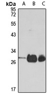 Anti-TPK1 Antibody