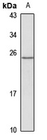 Anti-TREM2 Antibody