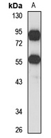 TRIM17 antibody