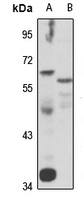 Anti-TRIM27 Antibody