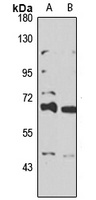 Anti-TRIM39 Antibody