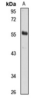 Anti-TRIM4 Antibody