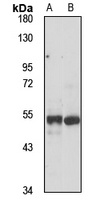 Anti-TRIM62 Antibody