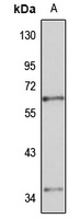 Anti-TRMT6 Antibody