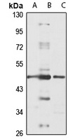 Anti-TRNT1 Antibody