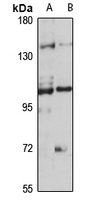 TRPC7 antibody