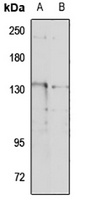 Anti-TRPM4 Antibody