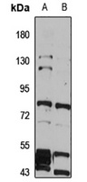 Anti-VRL-1 Antibody