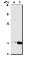 Anti-TSLP Antibody