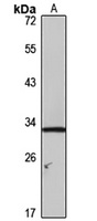 NET-7 antibody