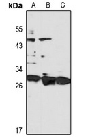 Anti-TSPAN31 Antibody