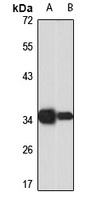 Anti-TSPY3 Antibody