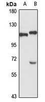 TSR1 antibody