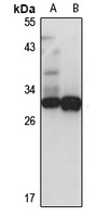 Anti-TSSK3 Antibody