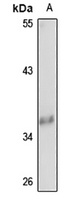 TTC1 antibody