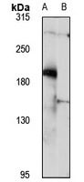 Anti-TTC3 Antibody