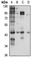 Anti-TTL Antibody