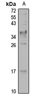Anti-TTP- alpha Antibody