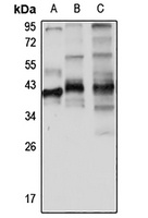 Twinfilin-1 antibody