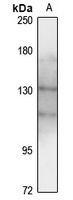 Anti-TYK2 Antibody