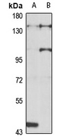 SR140 antibody