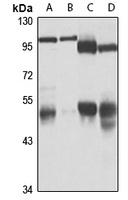Anti-UBA3 Antibody