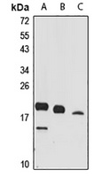 Anti-UBC12 Antibody