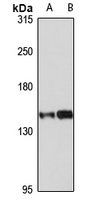UBE4B antibody