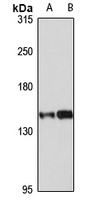 Anti-UBE4B Antibody