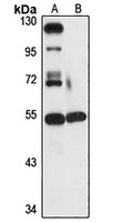 Anti-UBQLNL Antibody