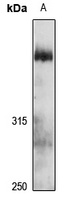 Anti-UBR4 Antibody