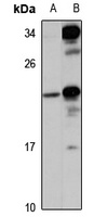 Anti-UFC1 Antibody