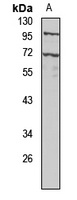 Anti-UGT2B7 Antibody