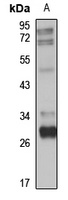 ULBP1 antibody