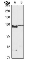 Munc13-4 antibody