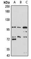 UNC5B antibody