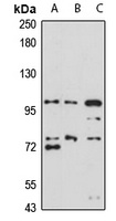 Anti-UNC5B Antibody