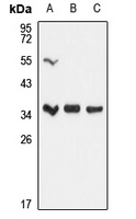 UPase 1 antibody
